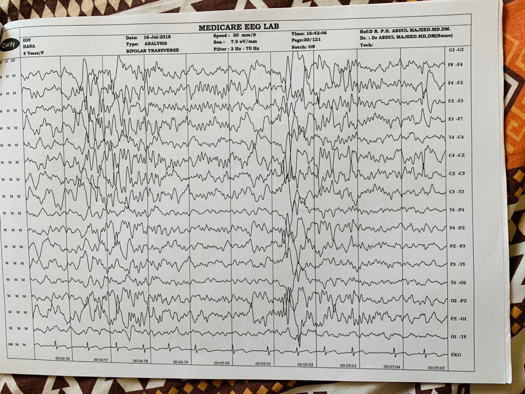 Patient Story